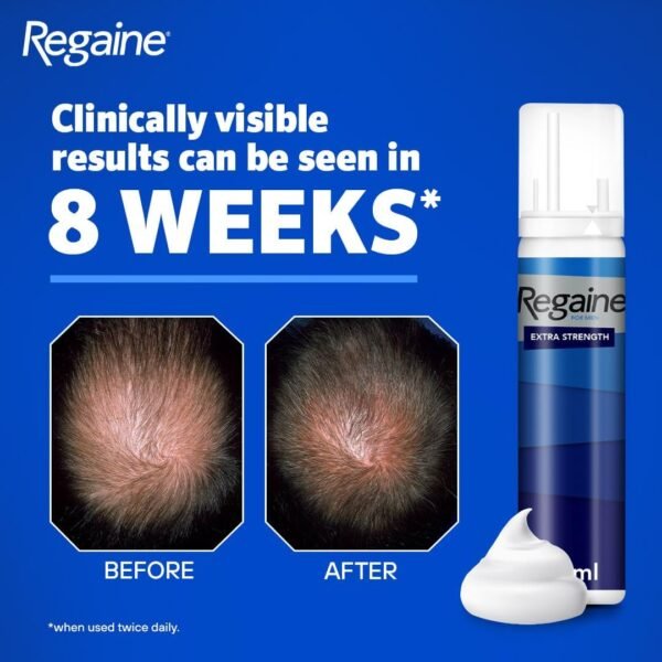 Regaine For Men Hair Regrowth Foam 3 x 73ml (Packing May Vary) - Image 5