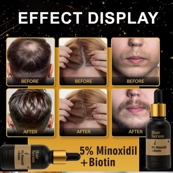 5% Minoxidil + Biotin Hair Serum, Reduces Hair Loss, Nourishes Hair and Scalp, Encourages Hair Growth - Image 5