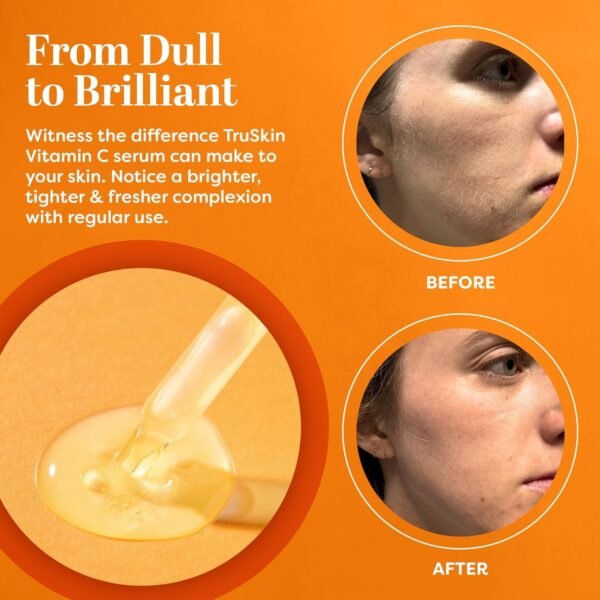 TruSkin Vitamin C Serum for Face – Anti Aging Face Serum with Vitamin C, Hyaluronic Acid, Vitamin E – Brightening Serum for Dark Spots, Even Skin Tone, Eye Area, Fine Lines & Wrinkles, 1 Fl Oz 30ml - Image 6